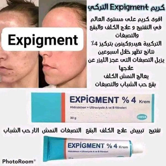 قل وداعا لمشاكل النمش الكلف والندوب مع كريم المعجزة Expigment créme pour visage